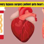Does every bypass surgery patient gets heart attack